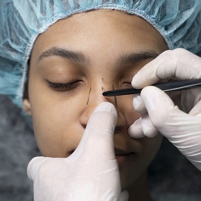 How much does rhinoplasty cost in Pakistan