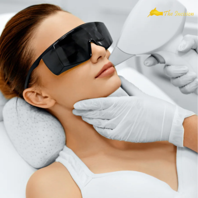 Laser Hair Removal in Islamabad