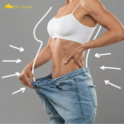 Transform Your Body with Expert-Led Weight Loss Treatment