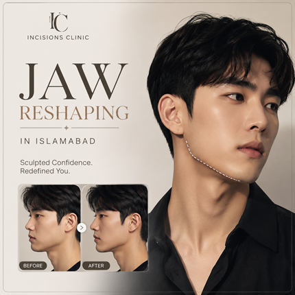 Jaw Surgery in Islamabad