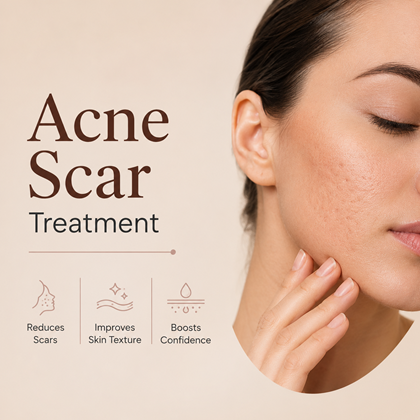 Acne Scar Treatment in Islamabad