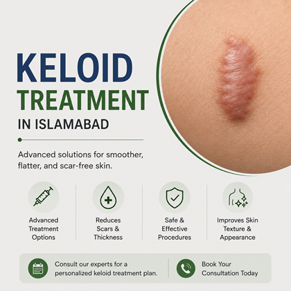 keloid treatment in islamabad